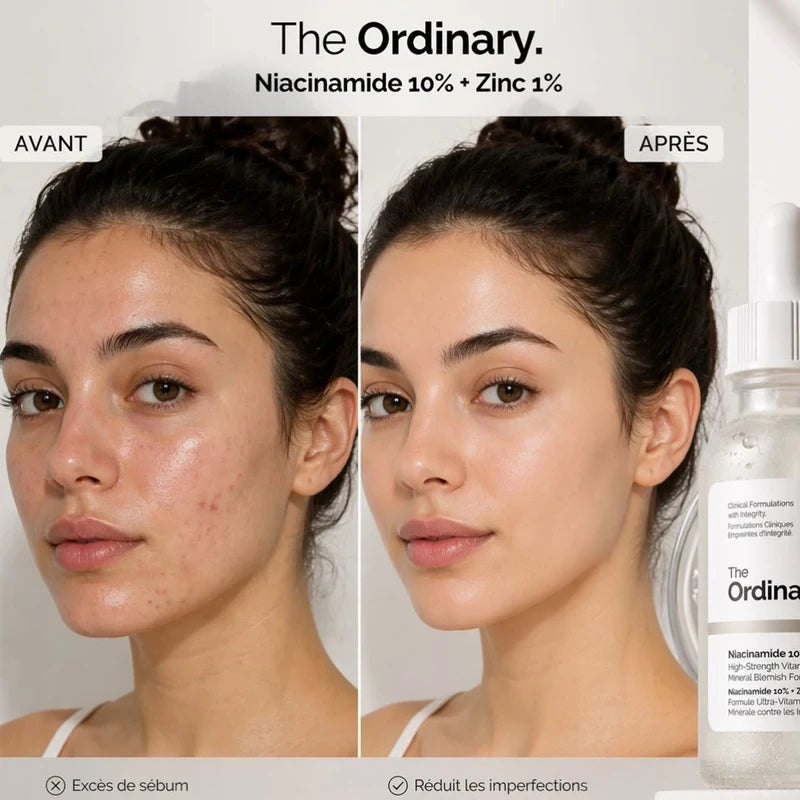 Niacinamide 10% + Zinc 1% Clarifying Serum