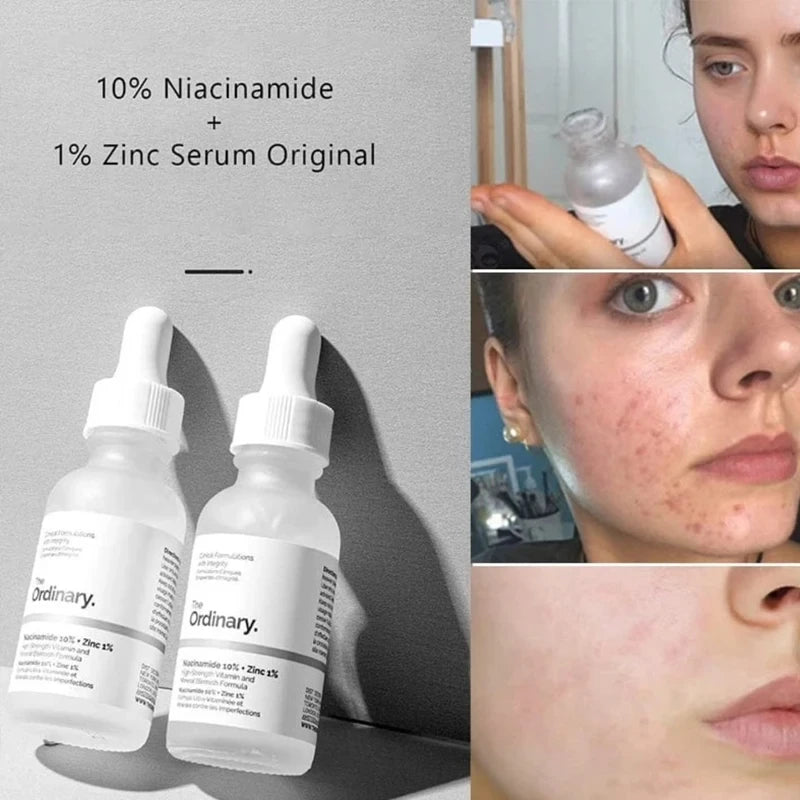 Niacinamide 10% + Zinc 1% Clarifying Serum